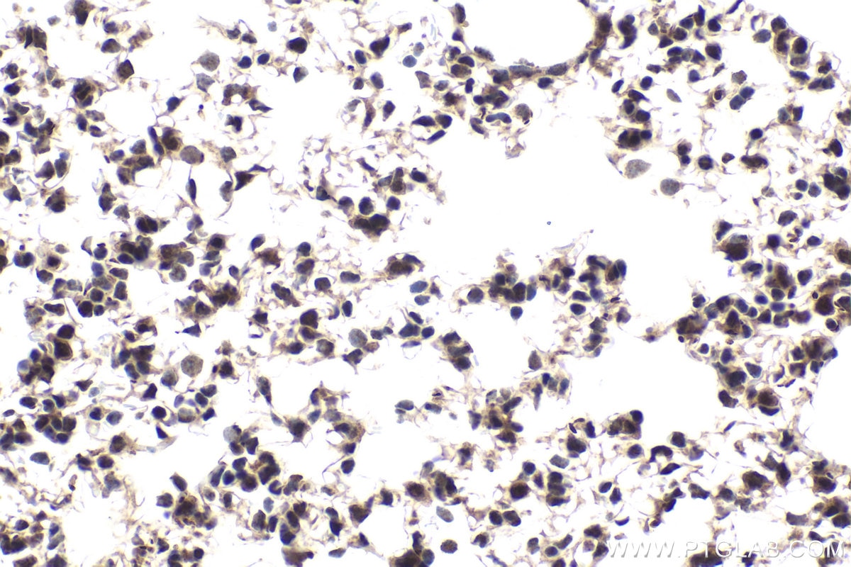 Immunohistochemical analysis of paraffin-embedded mouse lung tissue slide using KHC1892 (MNT IHC Kit).
