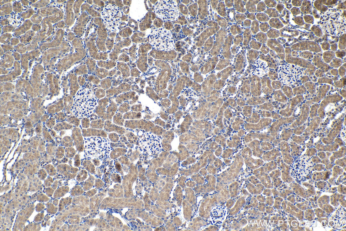 Immunohistochemical analysis of paraffin-embedded rat kidney tissue slide using KHC1401 (MOAP1 IHC Kit).