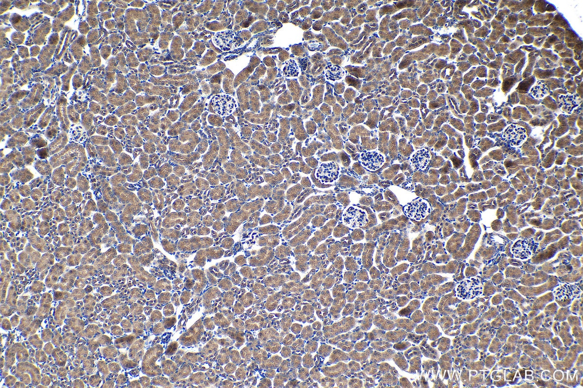 Immunohistochemical analysis of paraffin-embedded mouse kidney tissue slide using KHC1401 (MOAP1 IHC Kit).