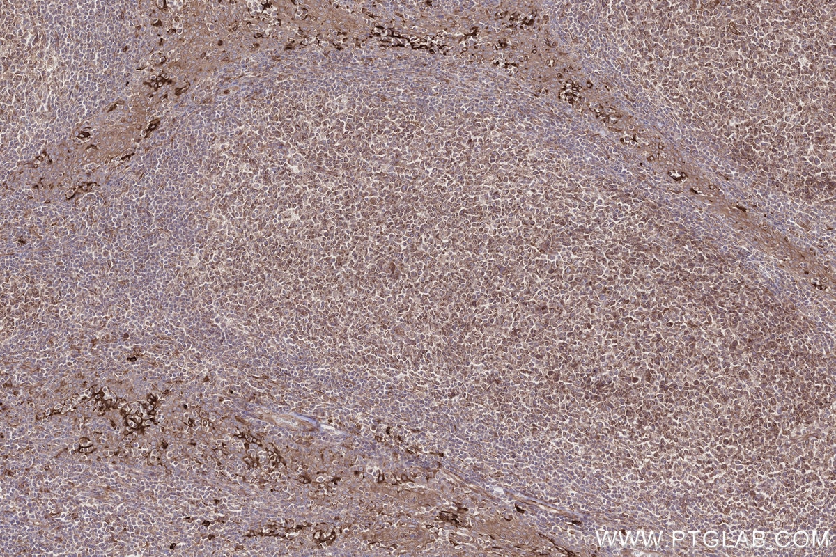 Immunohistochemical analysis of paraffin-embedded human tonsillitis tissue slide using KHC2700 (MOSPD2 IHC Kit).