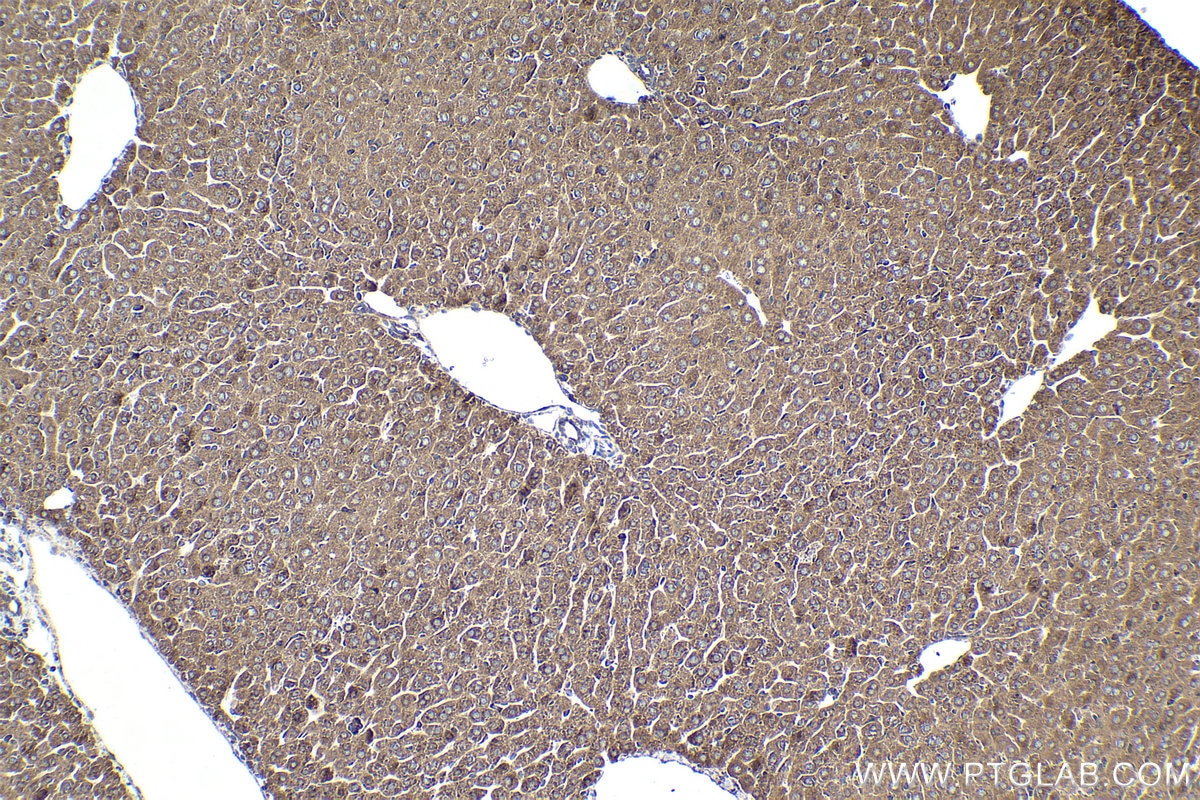 Immunohistochemical analysis of paraffin-embedded mouse liver tissue slide using KHC1946 (MOV10 IHC Kit).