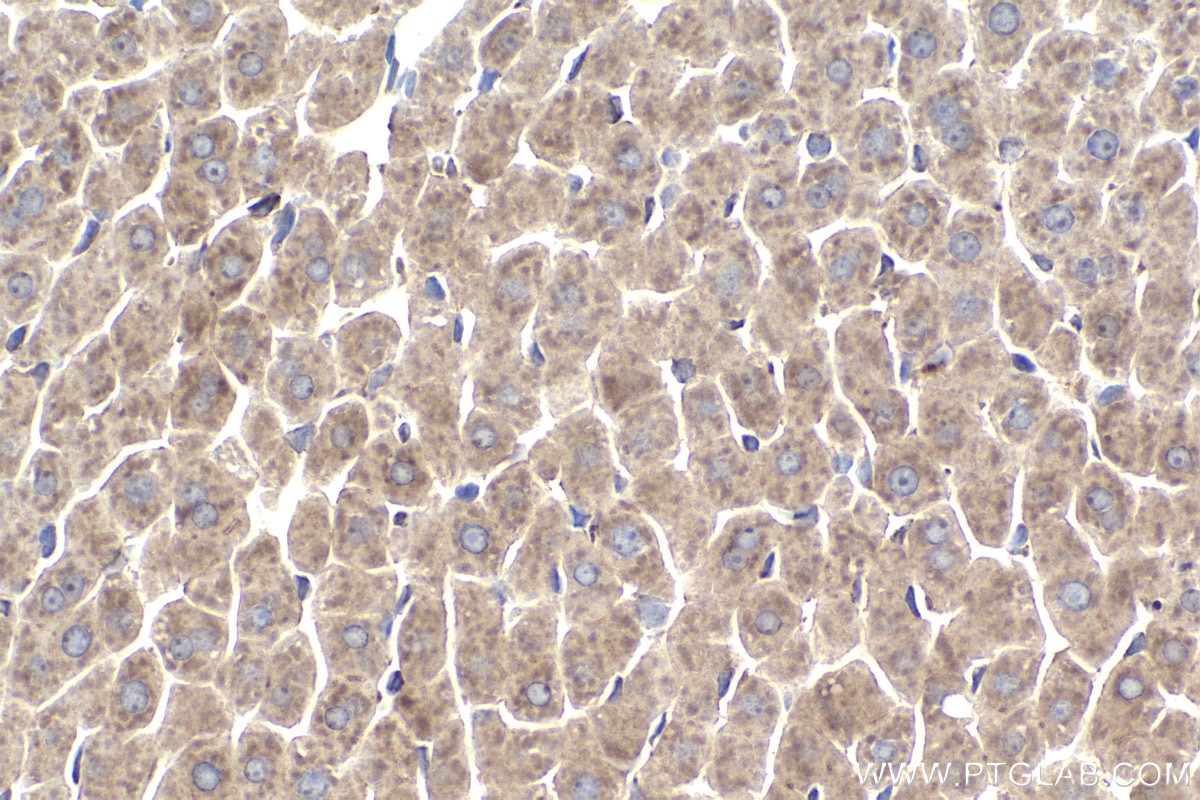 Immunohistochemical analysis of paraffin-embedded rat liver tissue slide using KHC1946 (MOV10 IHC Kit).
