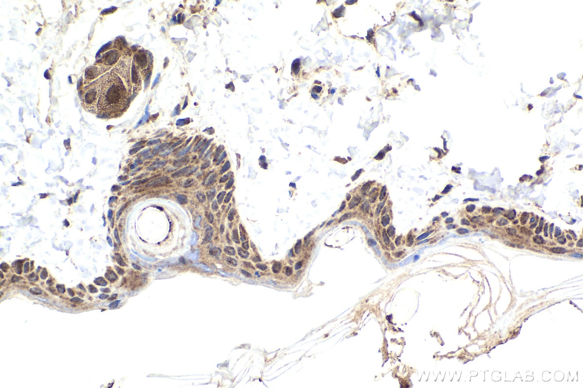 Immunohistochemical analysis of paraffin-embedded rat skin tissue slide using KHC1946 (MOV10 IHC Kit).