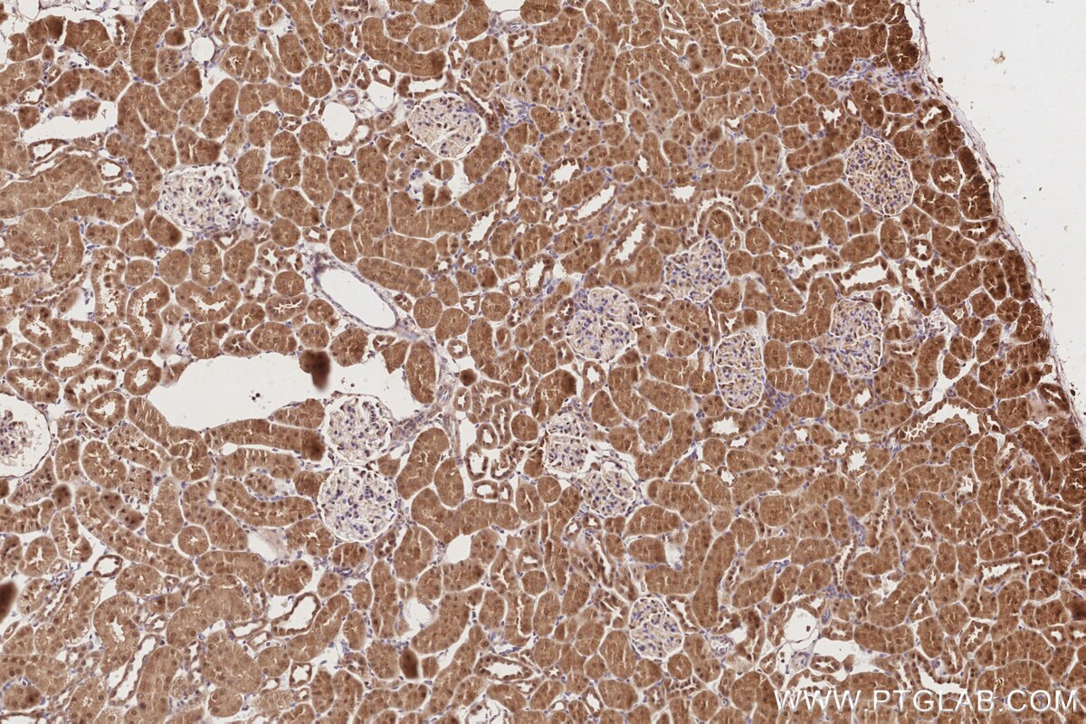 Immunohistochemical analysis of paraffin-embedded rat kidney tissue slide using KHC2841 (MPHOSPH6 IHC Kit).