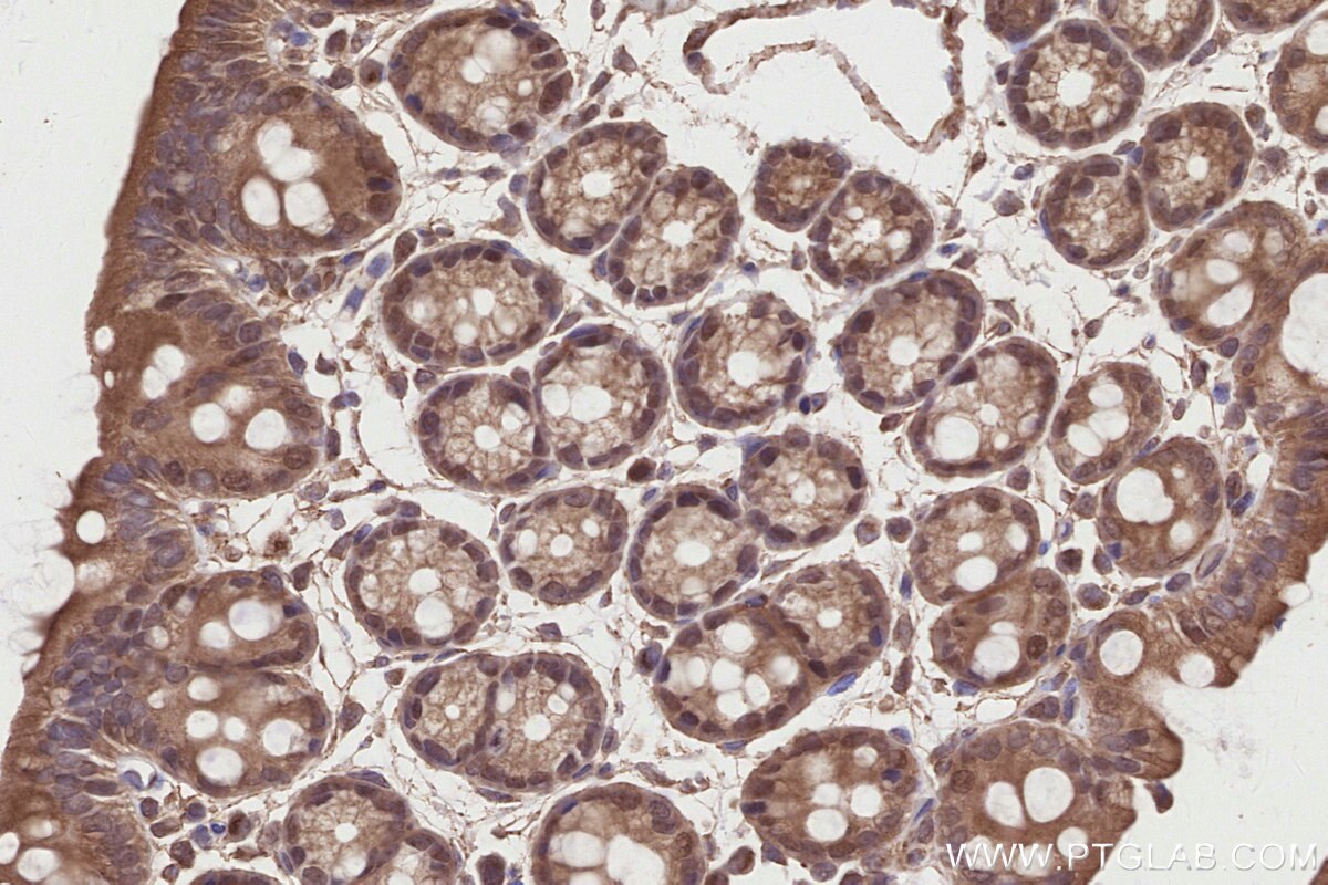 Immunohistochemical analysis of paraffin-embedded mouse colon tissue slide using KHC2841 (MPHOSPH6 IHC Kit).