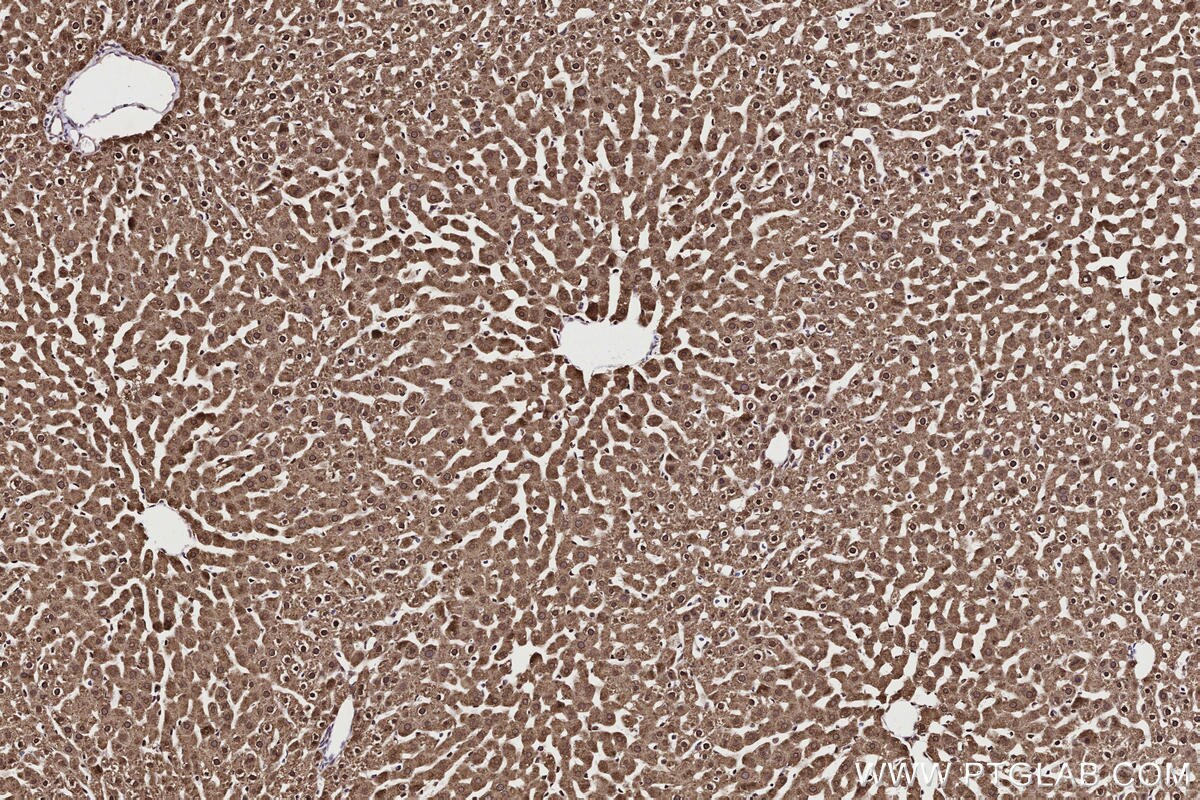 Immunohistochemical analysis of paraffin-embedded rat liver tissue slide using KHC2706 (MPLKIP/TTDN1 IHC Kit).