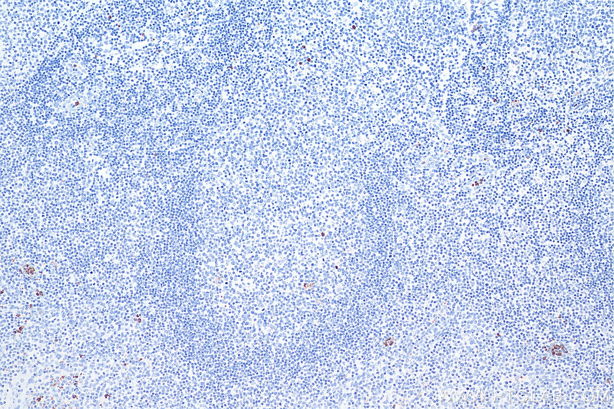 Immunohistochemical analysis of paraffin-embedded human tonsillitis tissue slide using KHC0040 (MPO IHC Kit).