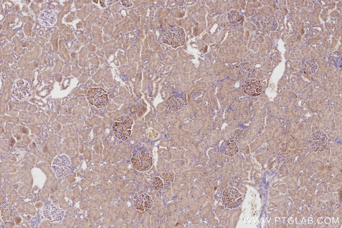 Immunohistochemical analysis of paraffin-embedded rat kidney tissue slide using KHC2758 (MRP1/ABCC1 IHC Kit).