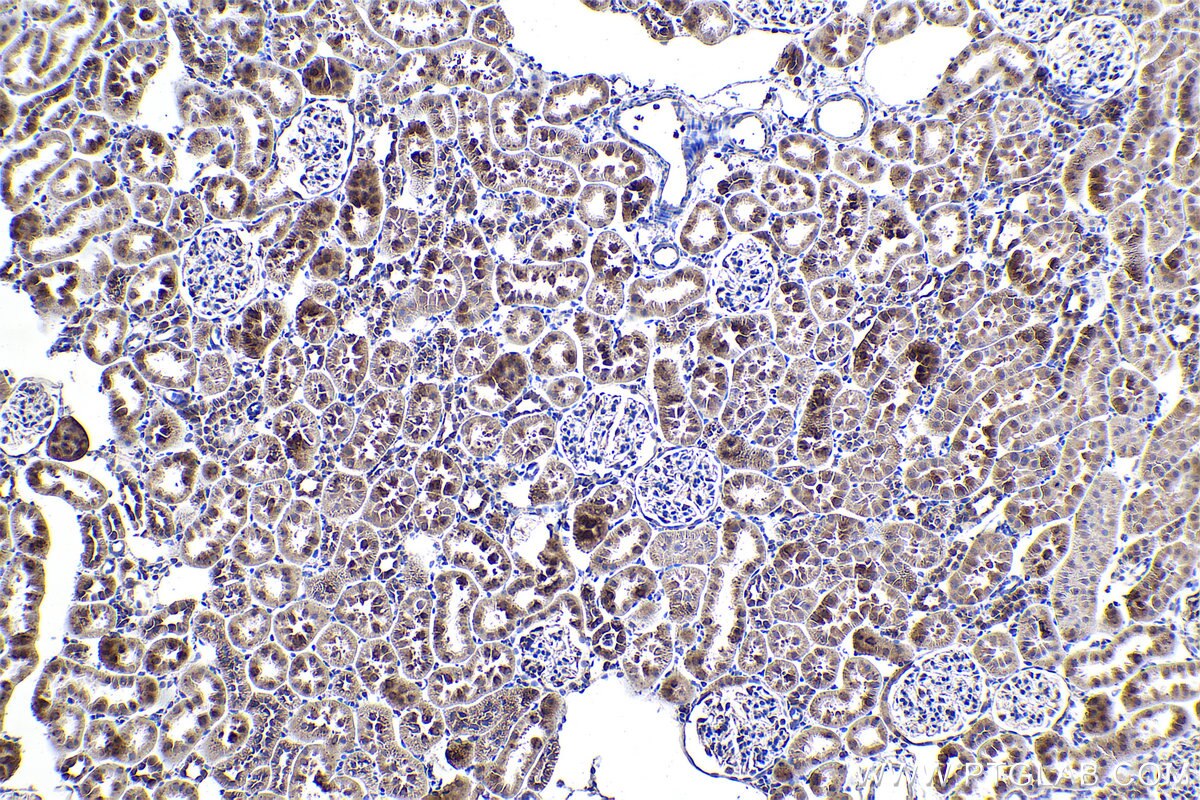 Immunohistochemical analysis of paraffin-embedded rat kidney tissue slide using KHC0893 (MRPL12 IHC Kit).