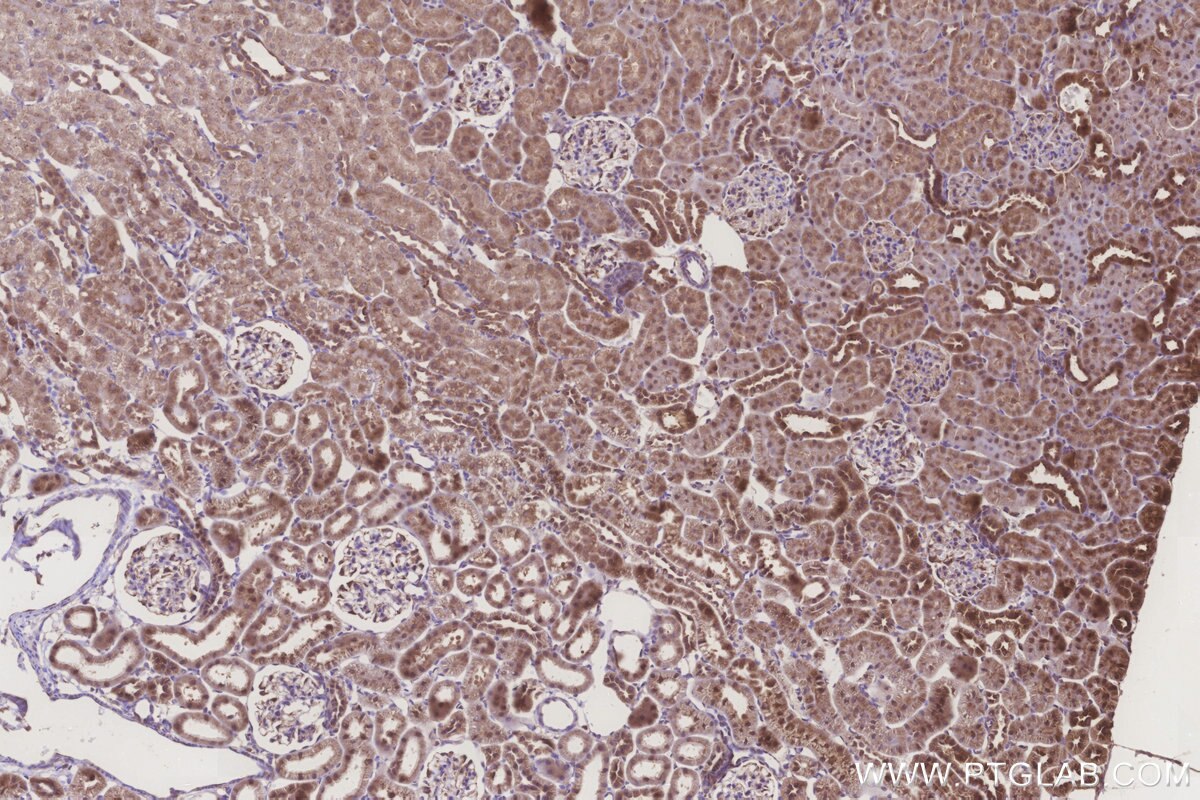 Immunohistochemical analysis of paraffin-embedded rat kidney tissue slide using KHC3249 (MRPL28 IHC Kit).
