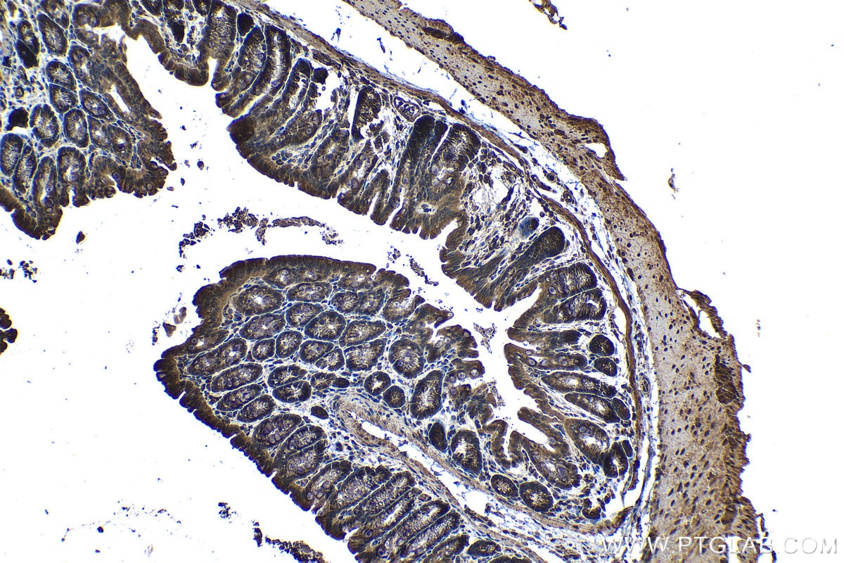 Immunohistochemical analysis of paraffin-embedded mouse colon tissue slide using KHC1315 (MRPL3 IHC Kit).