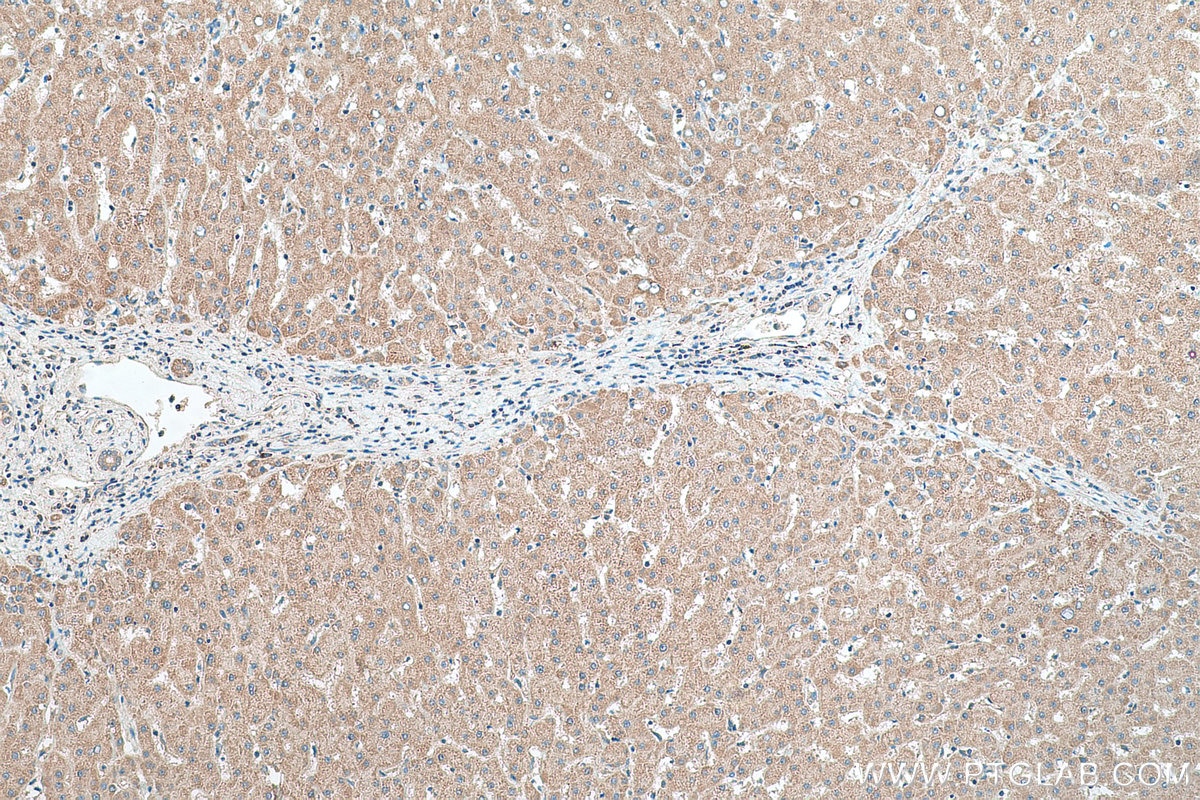 Immunohistochemical analysis of paraffin-embedded human liver tissue slide using KHC0436 (MRPL33 IHC Kit).