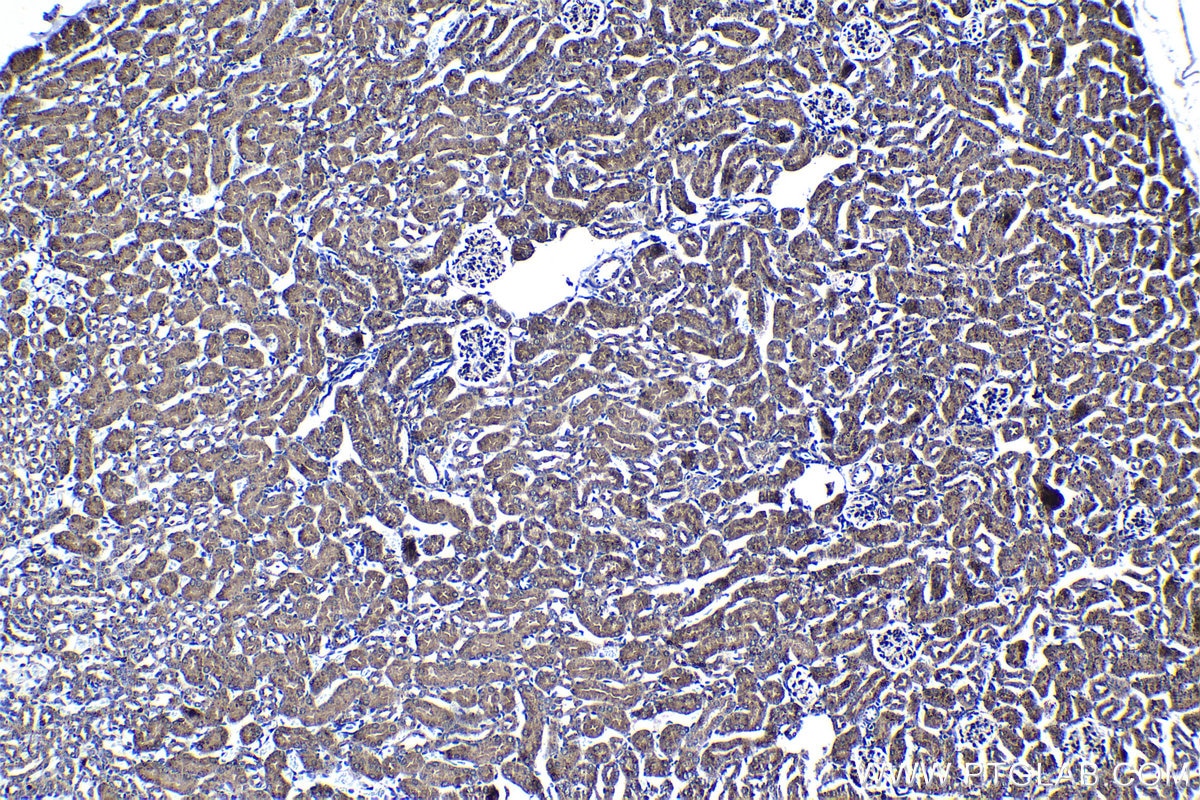 Immunohistochemical analysis of paraffin-embedded mouse kidney tissue slide using KHC1408 (MRPL42 IHC Kit).