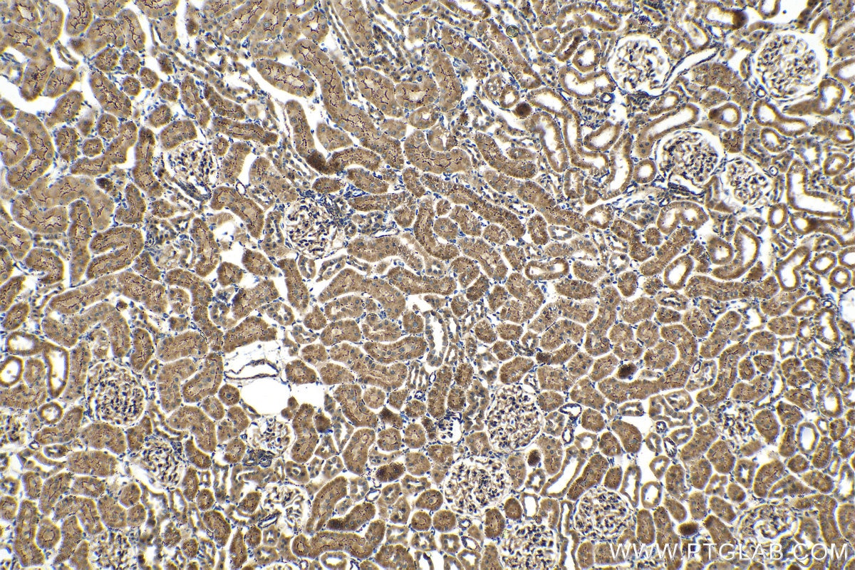 Immunohistochemical analysis of paraffin-embedded rat kidney tissue slide using KHC1408 (MRPL42 IHC Kit).