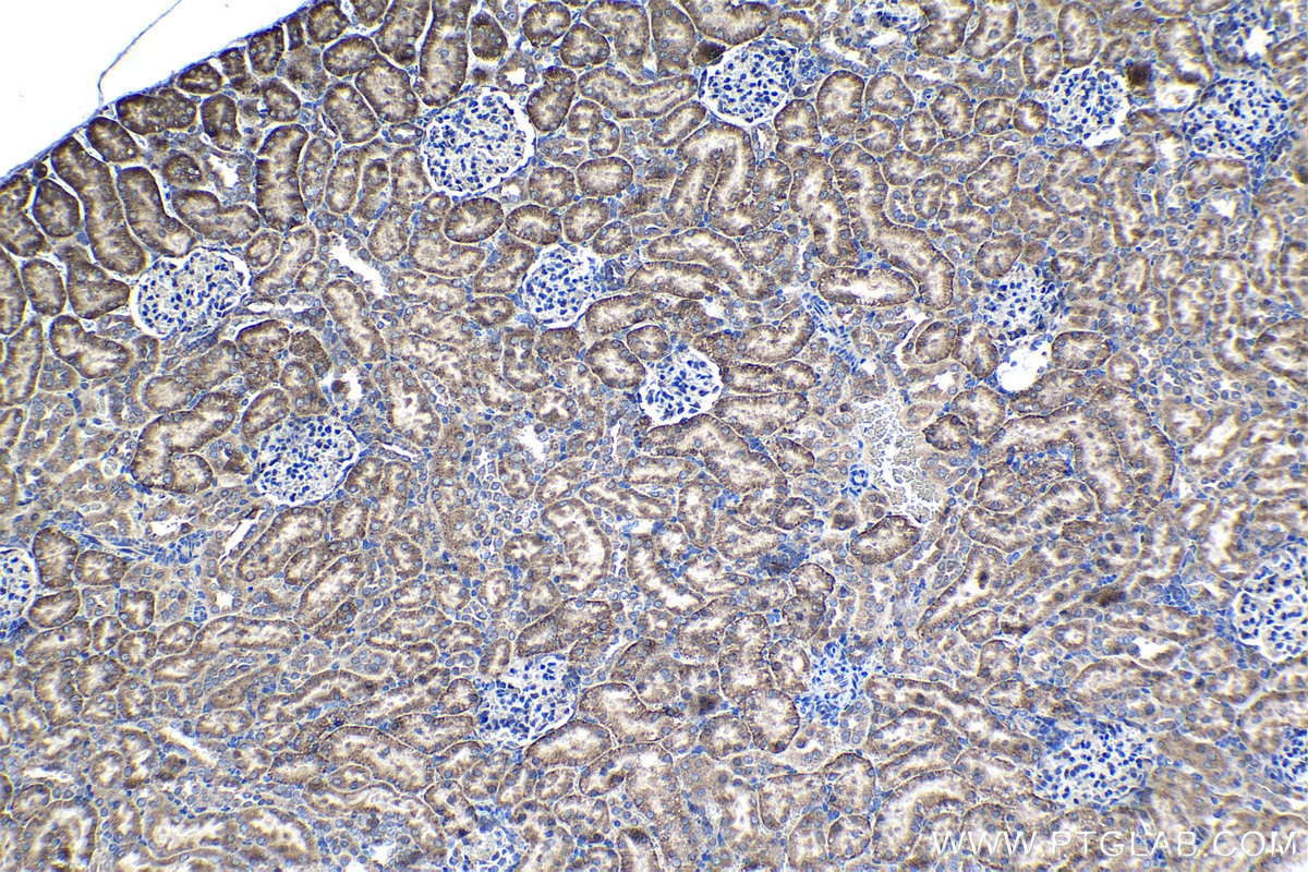 Immunohistochemical analysis of paraffin-embedded rat kidney tissue slide using KHC1365 (MRPL49 IHC Kit).