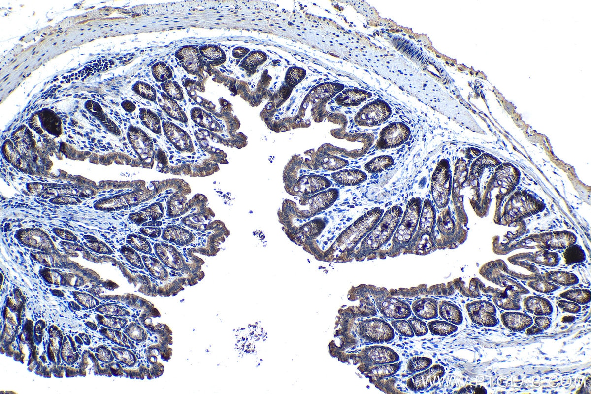 Immunohistochemical analysis of paraffin-embedded mouse colon tissue slide using KHC1365 (MRPL49 IHC Kit).