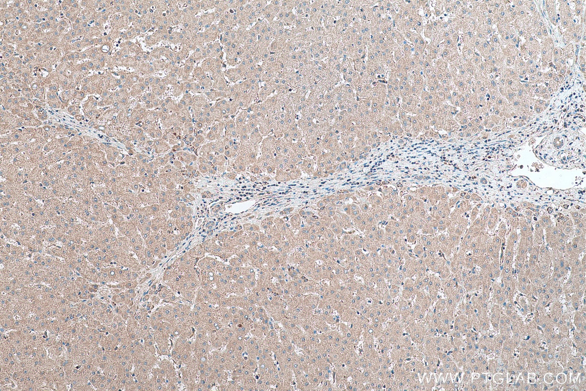 Immunohistochemical analysis of paraffin-embedded human liver tissue slide using KHC0437 (MRPS28 IHC Kit).