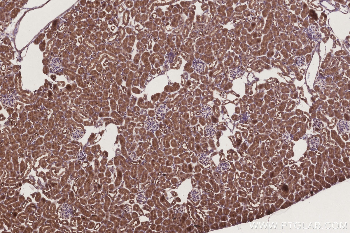 Immunohistochemical analysis of paraffin-embedded mouse kidney tissue slide using KHC3306 (MRPS31 IHC Kit).