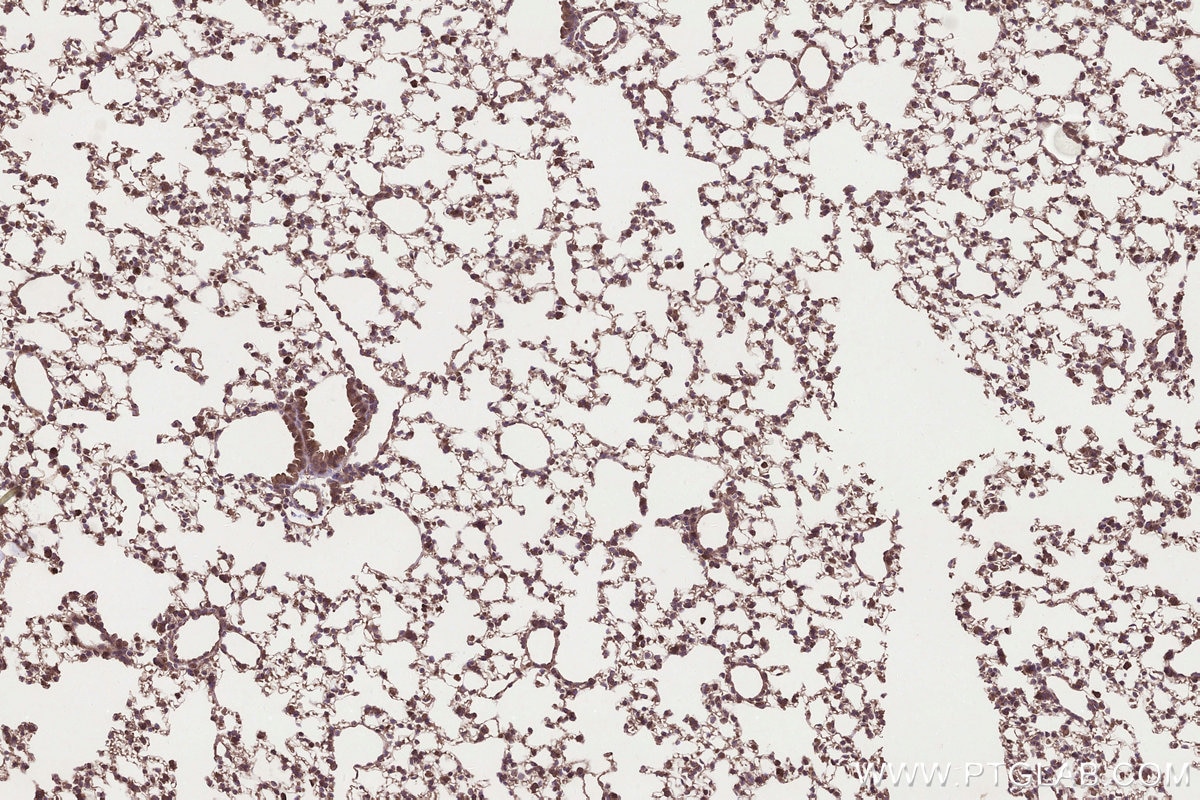 Immunohistochemical analysis of paraffin-embedded mouse lung tissue slide using KHC3306 (MRPS31 IHC Kit).
