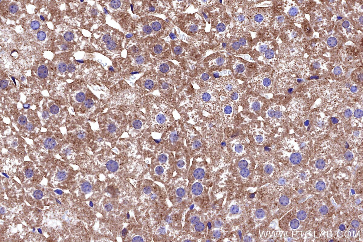 Immunohistochemical analysis of paraffin-embedded mouse liver tissue slide using KHC3241 (MRPS6 IHC Kit).