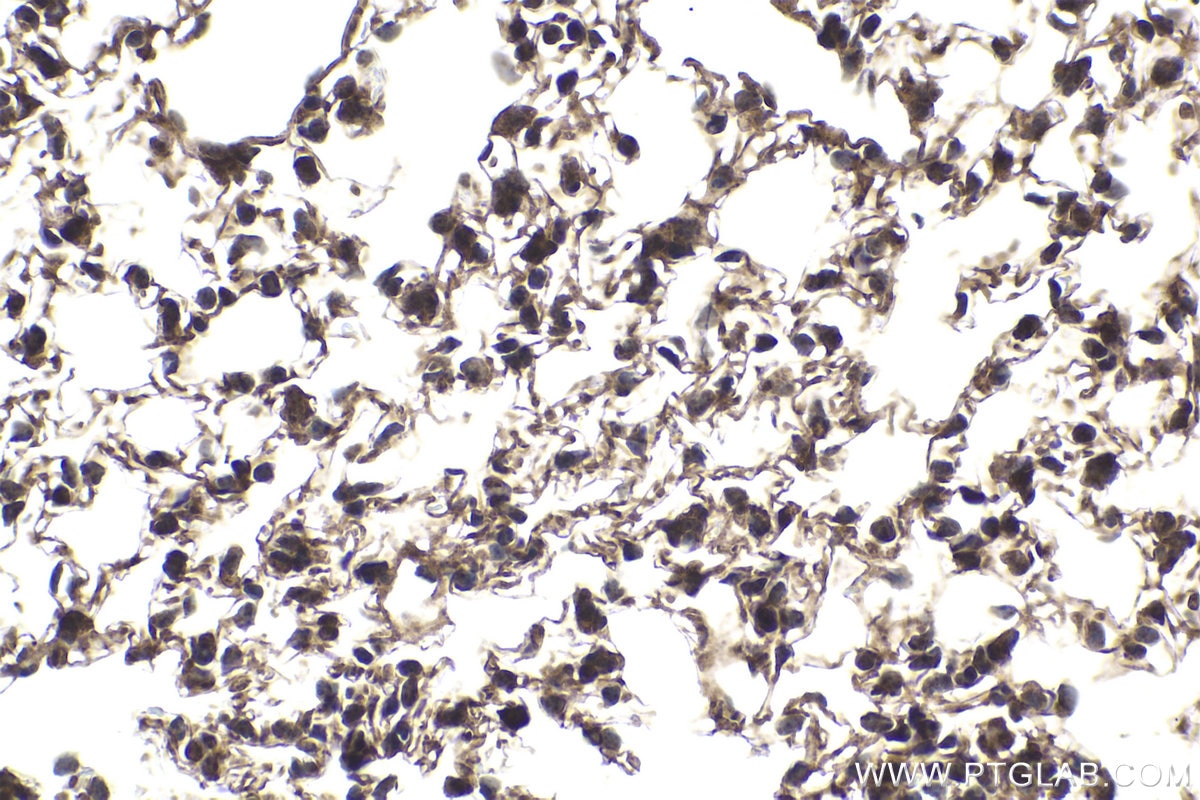 Immunohistochemical analysis of paraffin-embedded mouse lung tissue slide using KHC1865 (MRTFA/MKL1 IHC Kit).