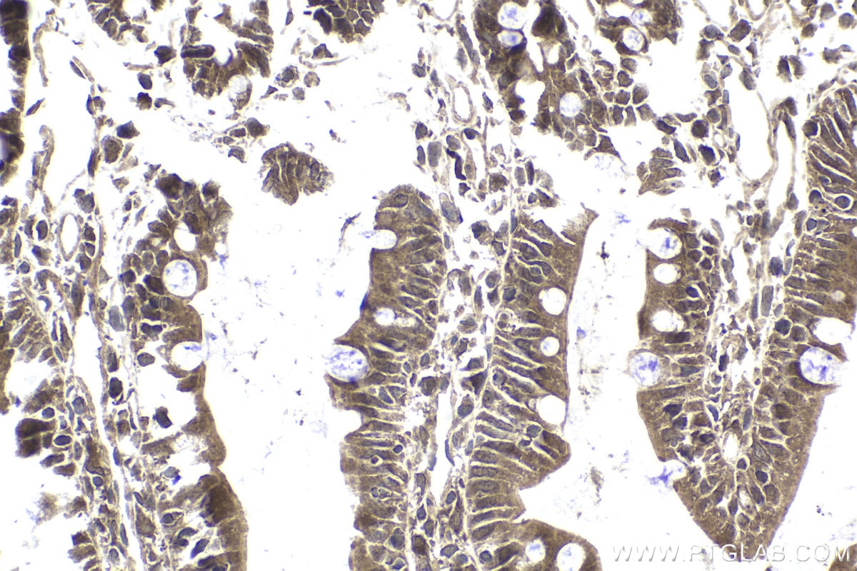 Immunohistochemical analysis of paraffin-embedded rat small intestine tissue slide using KHC1865 (MRTFA/MKL1 IHC Kit).