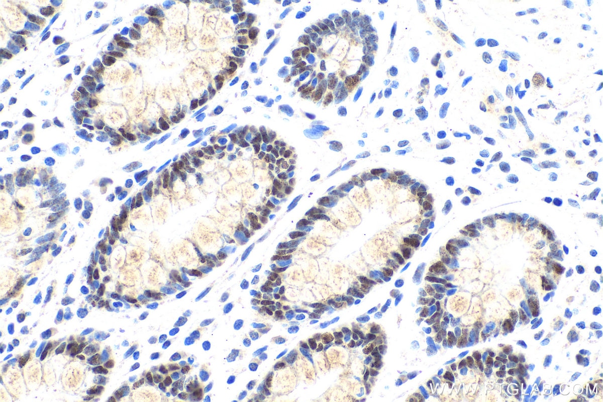 Immunohistochemical analysis of paraffin-embedded human colon tissue slide using KHC0733 (MSH6 IHC Kit).