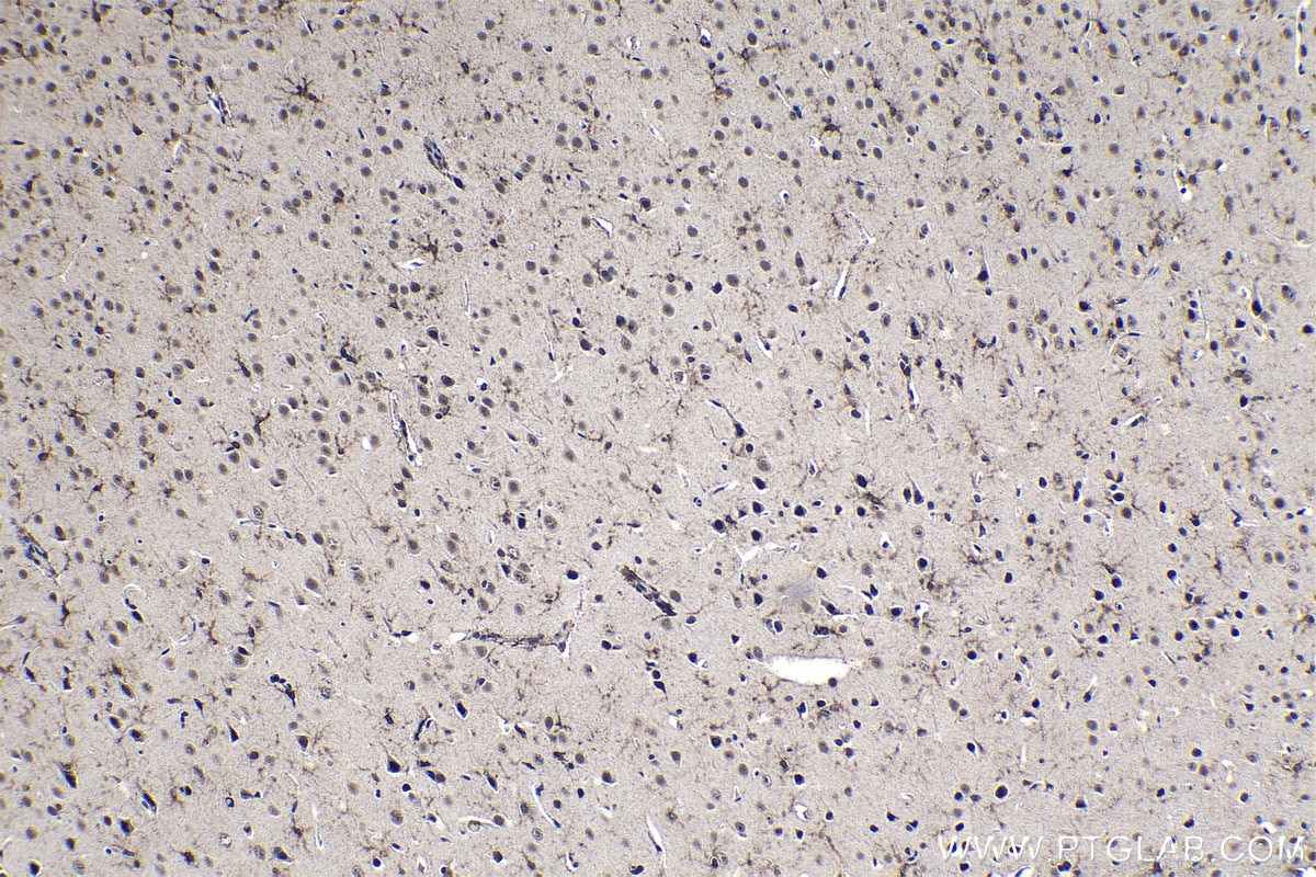 Immunohistochemical analysis of paraffin-embedded rat brain tissue slide using KHC1211 (MSI1 IHC Kit).