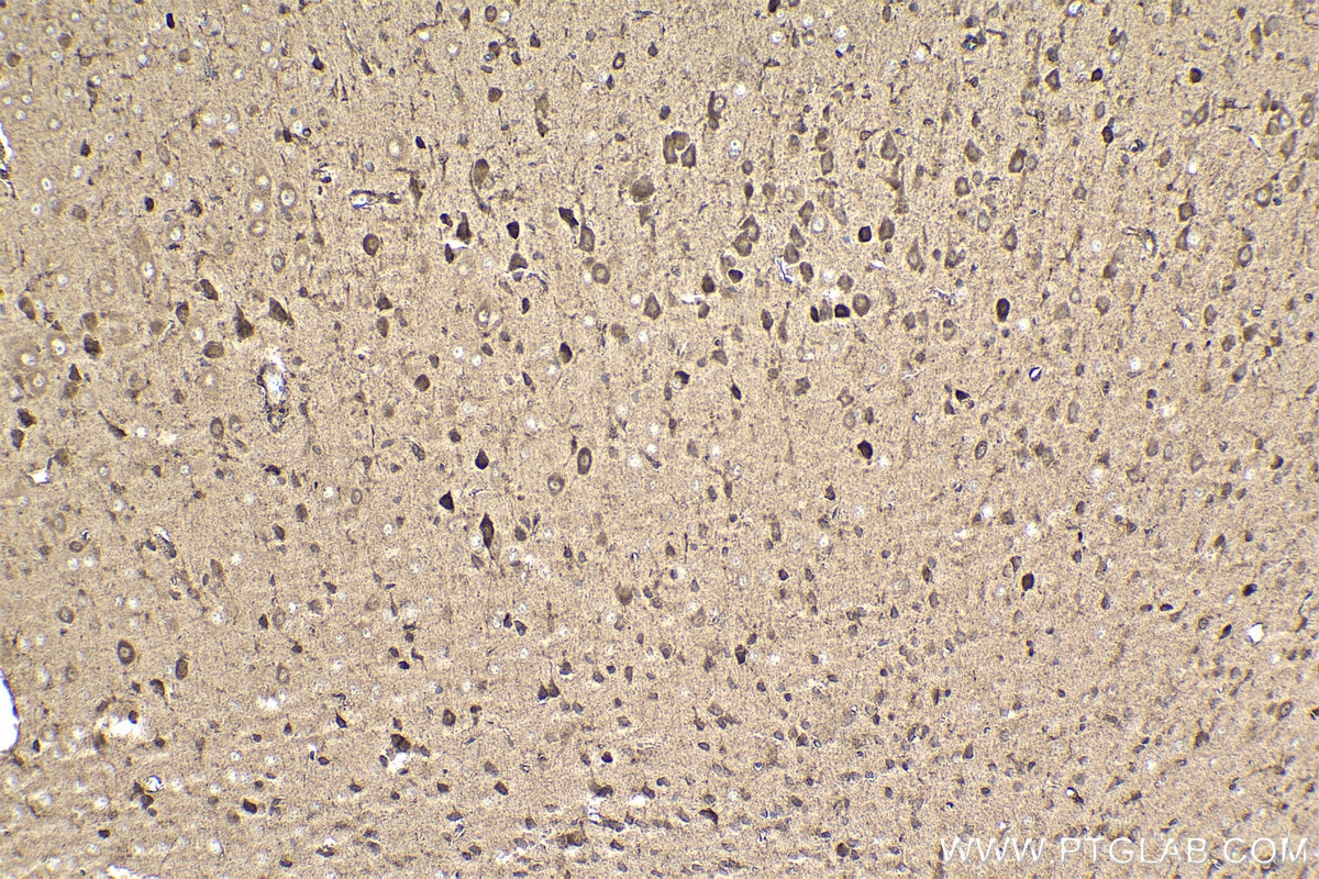 Immunohistochemical analysis of paraffin-embedded mouse brain tissue slide using KHC1014 (MSI2 IHC Kit).
