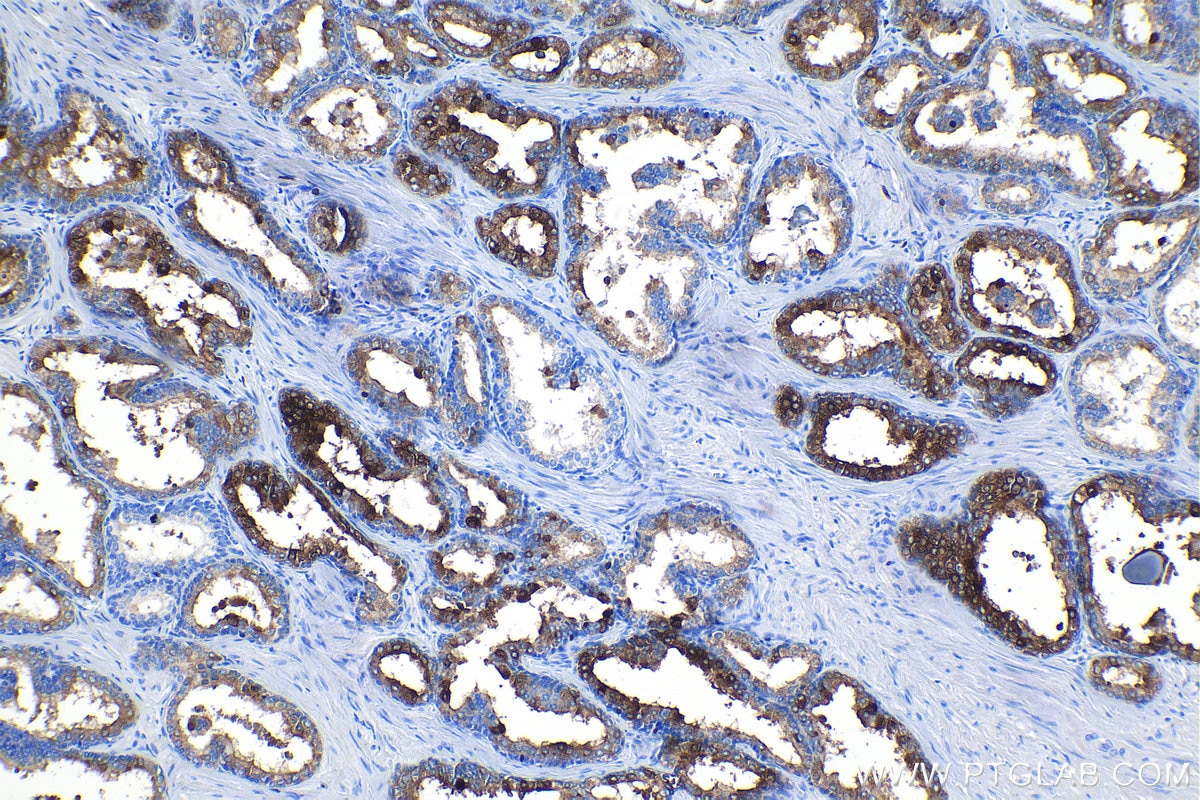 Immunohistochemical analysis of paraffin-embedded human prostate hyperplasia tissue slide using KHC1106 (MSMB IHC Kit).
