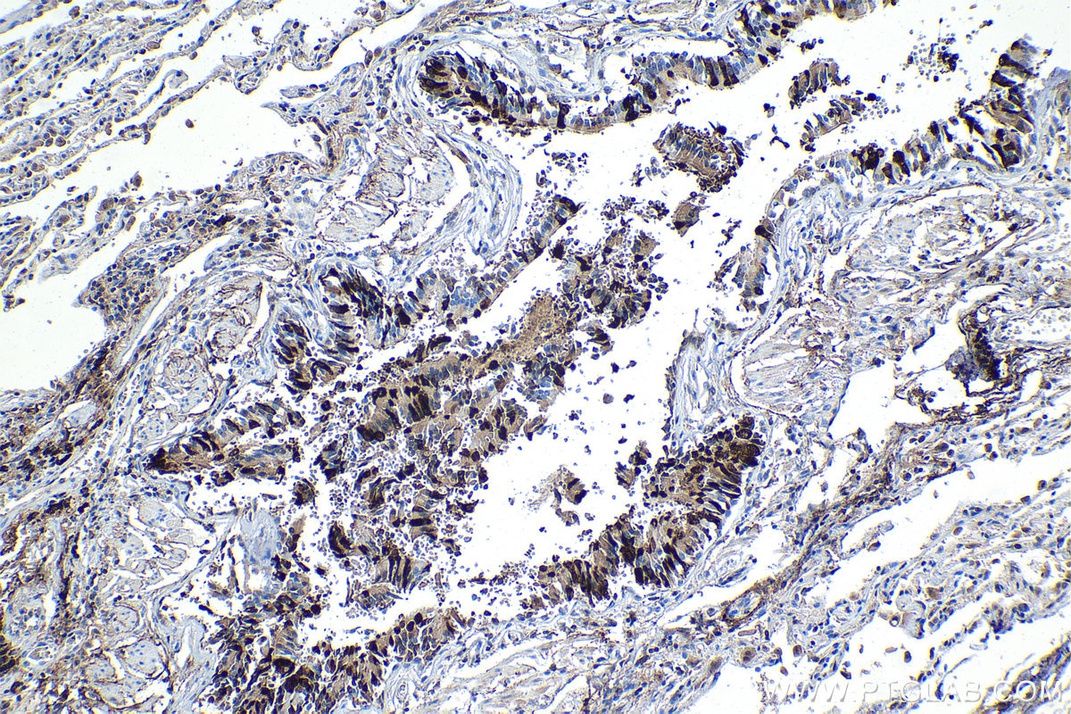 Immunohistochemical analysis of paraffin-embedded human lung tissue slide using KHC1106 (MSMB IHC Kit).