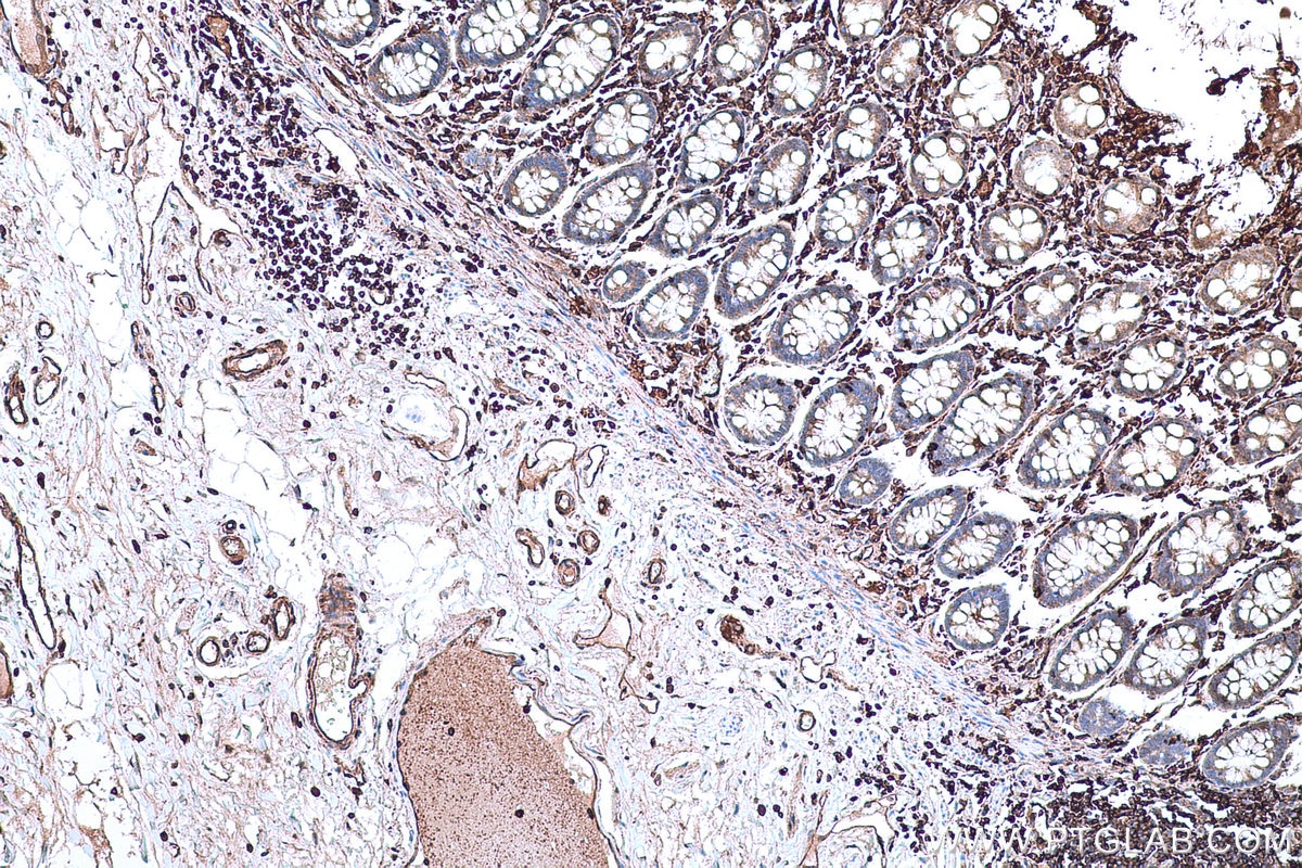 Immunohistochemical analysis of paraffin-embedded human colon tissue slide using KHC0664 (MSN IHC Kit).