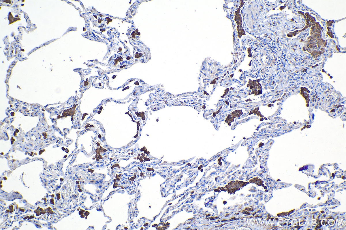 Immunohistochemical analysis of paraffin-embedded human lung tissue slide using KHC1138 (MSR1 IHC Kit).