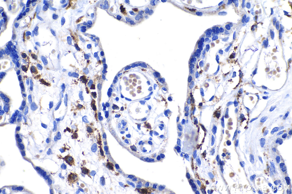 Immunohistochemical analysis of paraffin-embedded human placenta tissue slide using KHC1138 (MSR1 IHC Kit).
