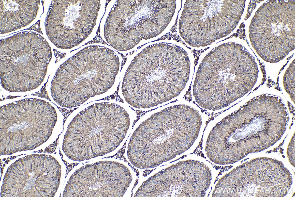 Immunohistochemical analysis of paraffin-embedded rat testis tissue slide using KHC1262 (MSRB3 IHC Kit).