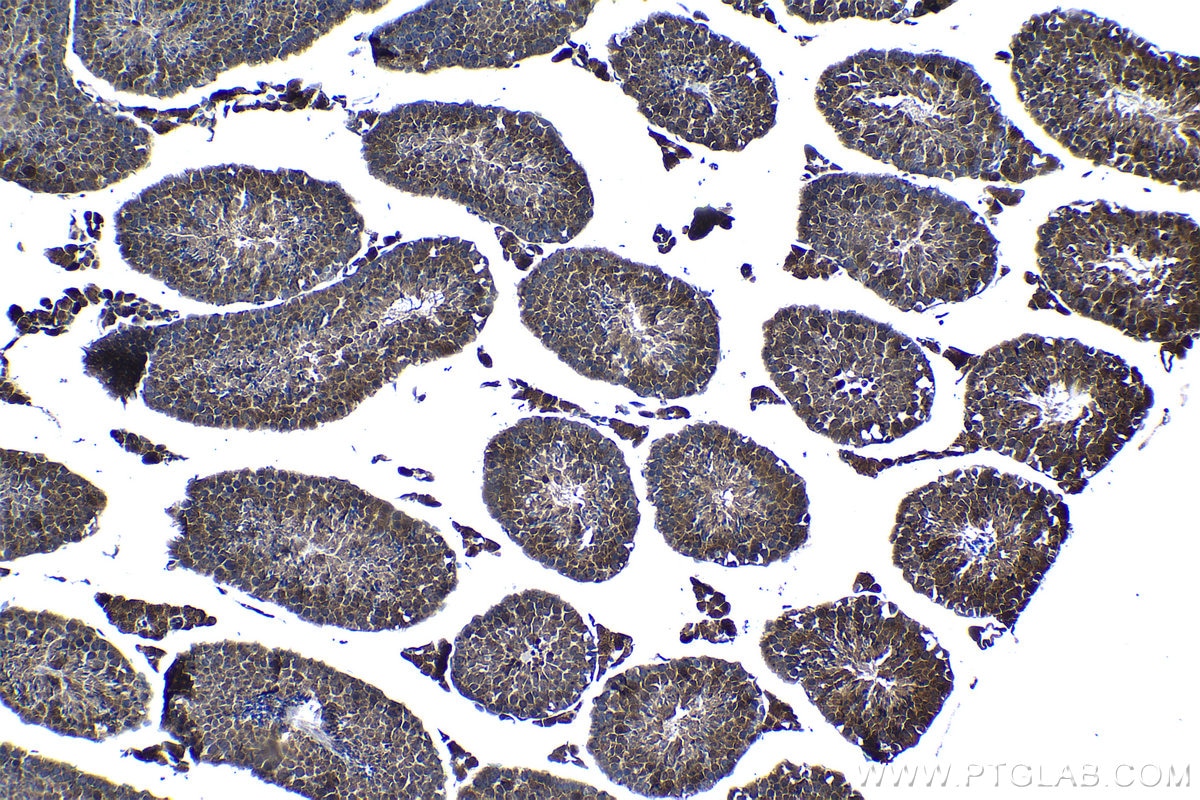 Immunohistochemical analysis of paraffin-embedded mouse testis tissue slide using KHC1262 (MSRB3 IHC Kit).