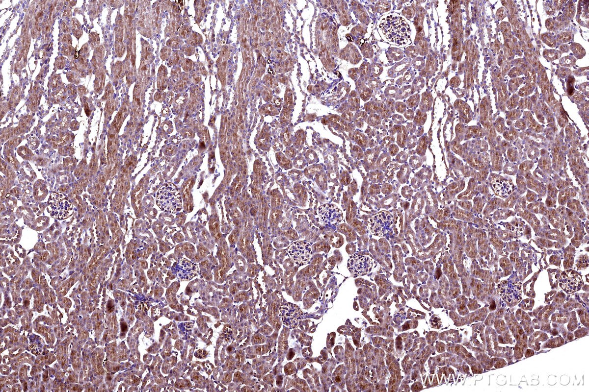 Immunohistochemical analysis of paraffin-embedded mouse kidney tissue slide using KHC3165 (MT-ND5 IHC Kit).