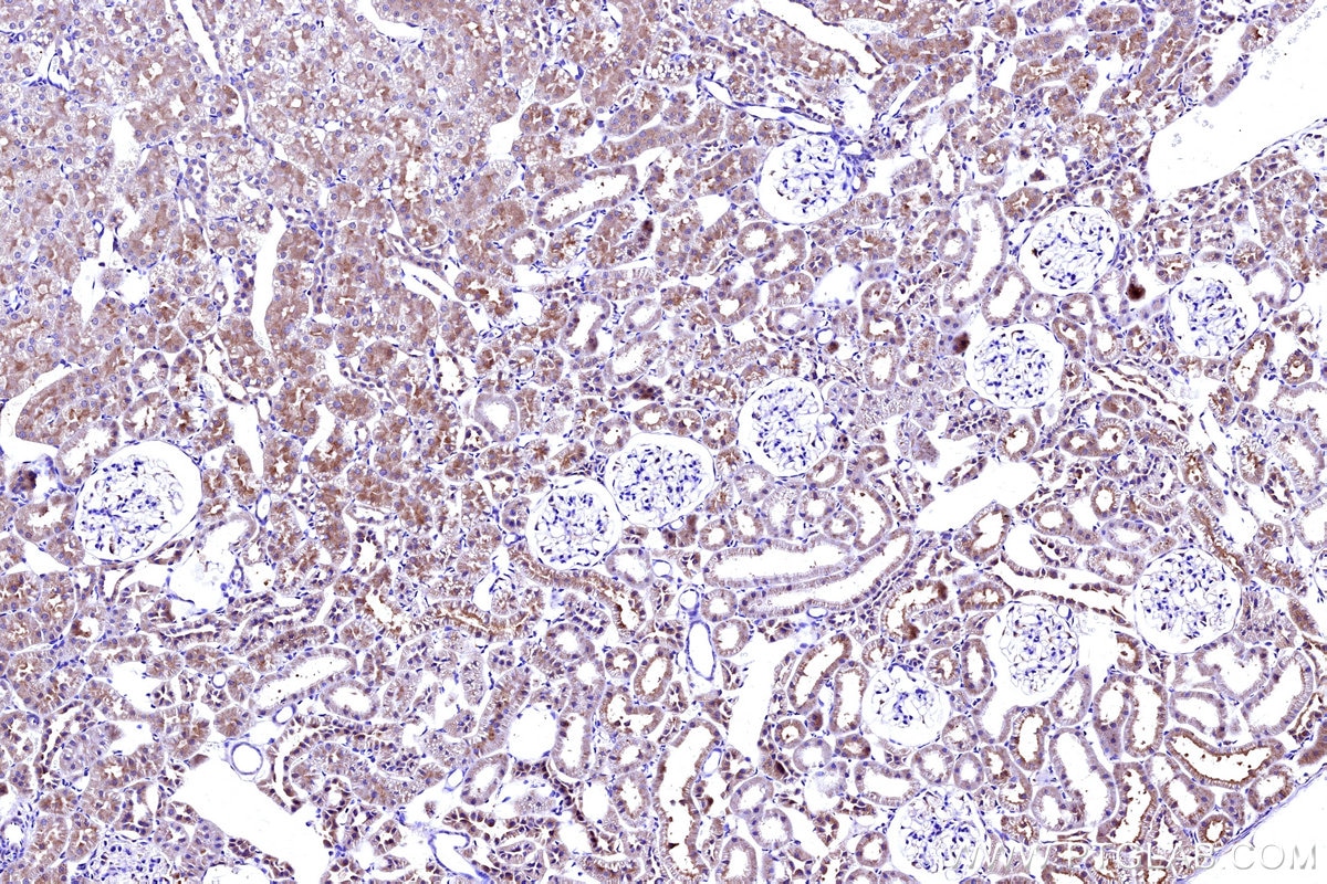 Immunohistochemical analysis of paraffin-embedded rat kidney tissue slide using KHC3165 (MT-ND5 IHC Kit).