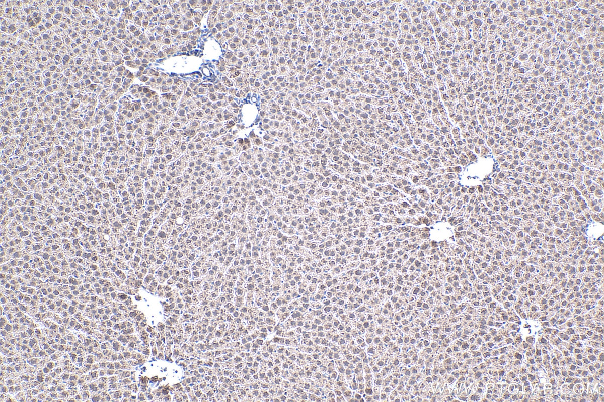 Immunohistochemical analysis of paraffin-embedded rat liver tissue slide using KHC0438 (MT2A IHC Kit).