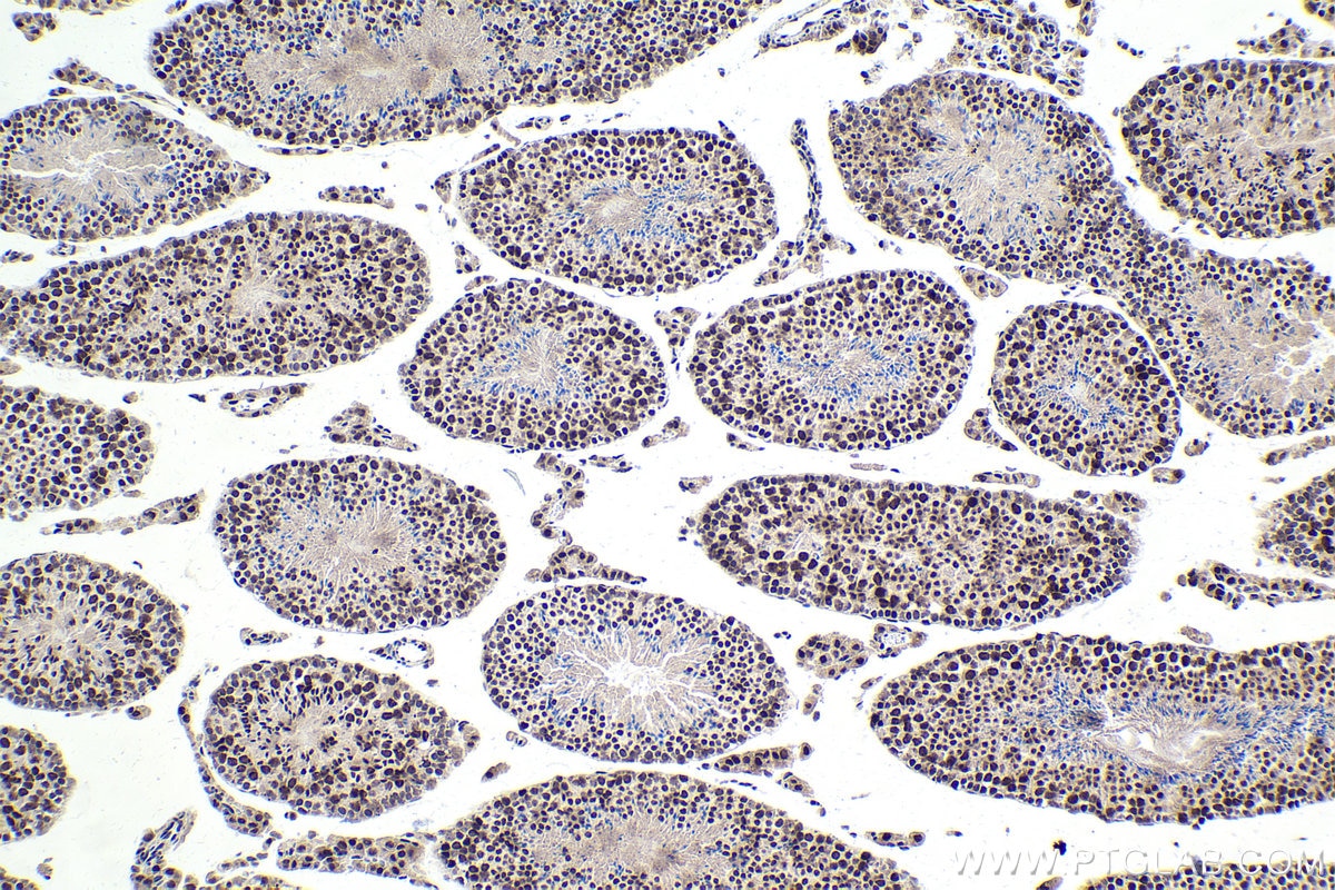 Immunohistochemical analysis of paraffin-embedded mouse testis tissue slide using KHC1710 (MTA1 IHC Kit).