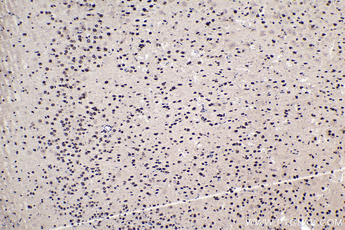 Immunohistochemical analysis of paraffin-embedded rat brain tissue slide using KHC1710 (MTA1 IHC Kit).