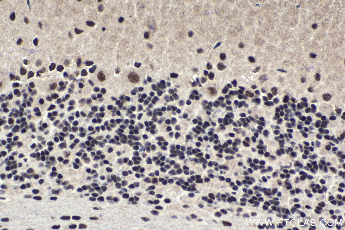 Immunohistochemical analysis of paraffin-embedded rat cerebellum tissue slide using KHC1710 (MTA1 IHC Kit).