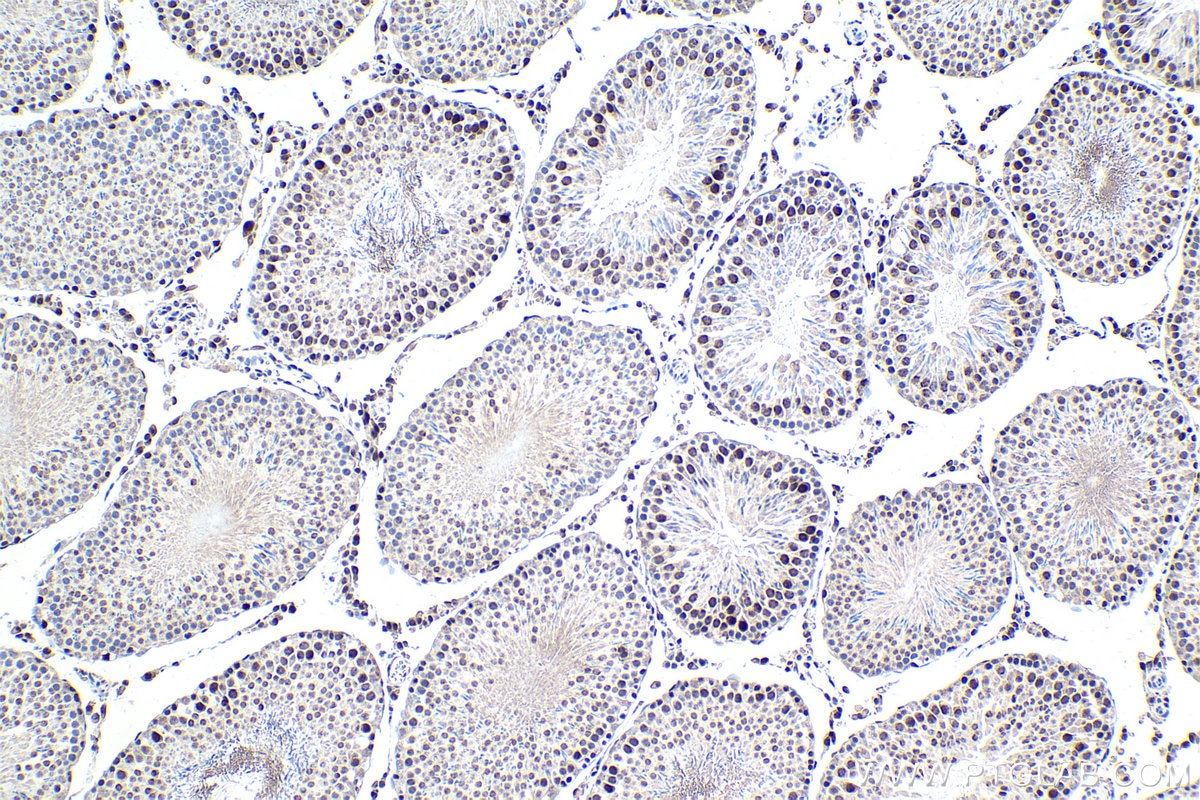 Immunohistochemical analysis of paraffin-embedded rat testis tissue slide using KHC1710 (MTA1 IHC Kit).