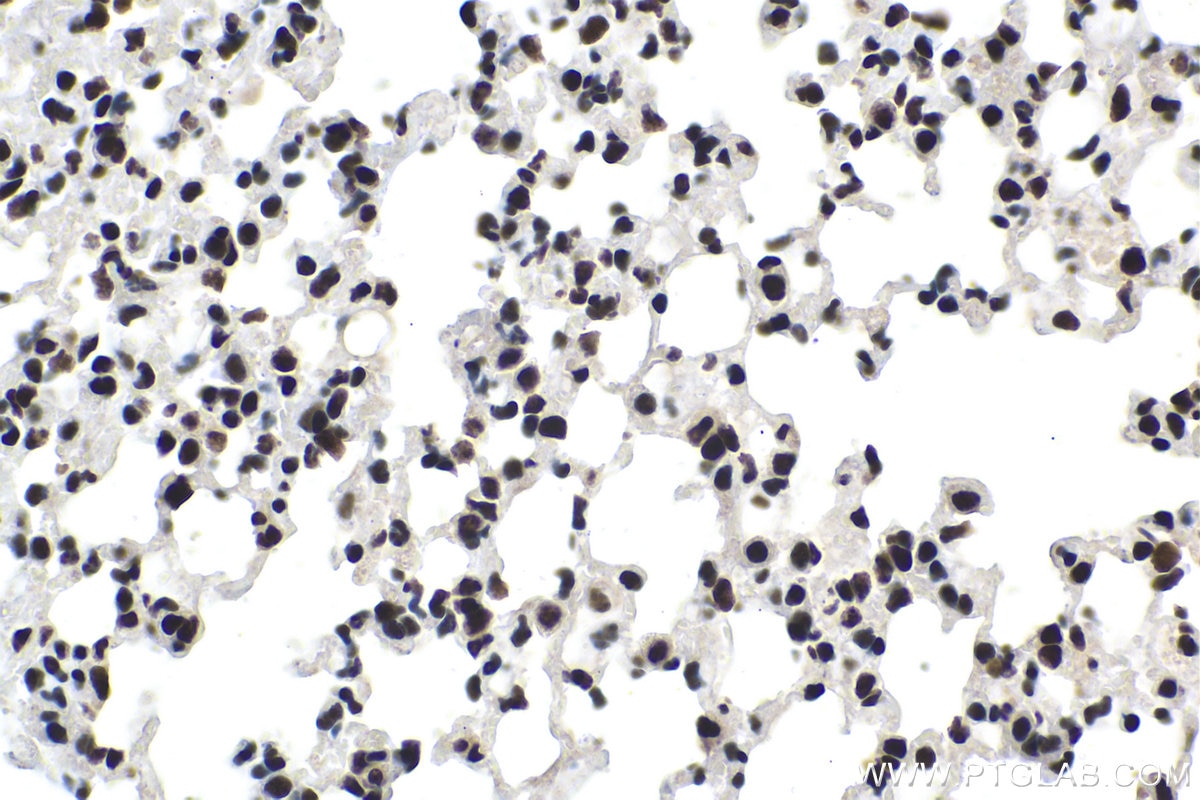Immunohistochemical analysis of paraffin-embedded mouse lung tissue slide using KHC1481 (MTA2 IHC Kit).