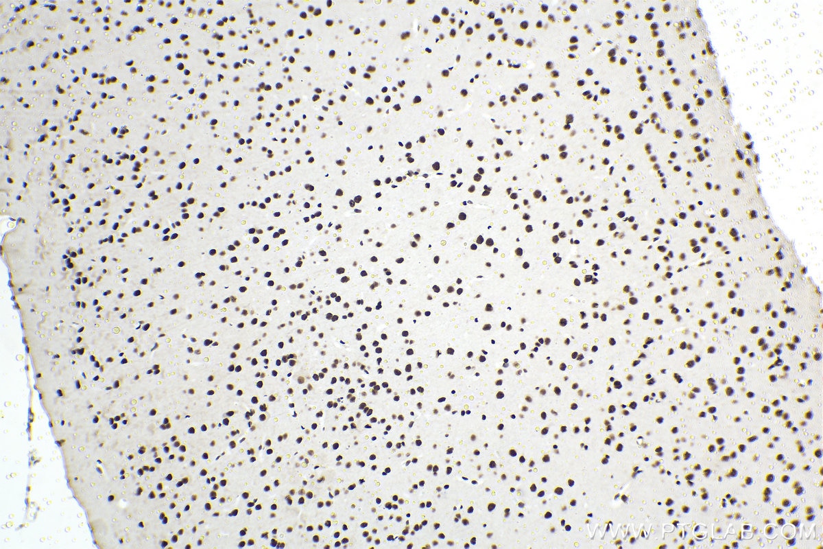 Immunohistochemical analysis of paraffin-embedded mouse brain tissue slide using KHC1481 (MTA2 IHC Kit).