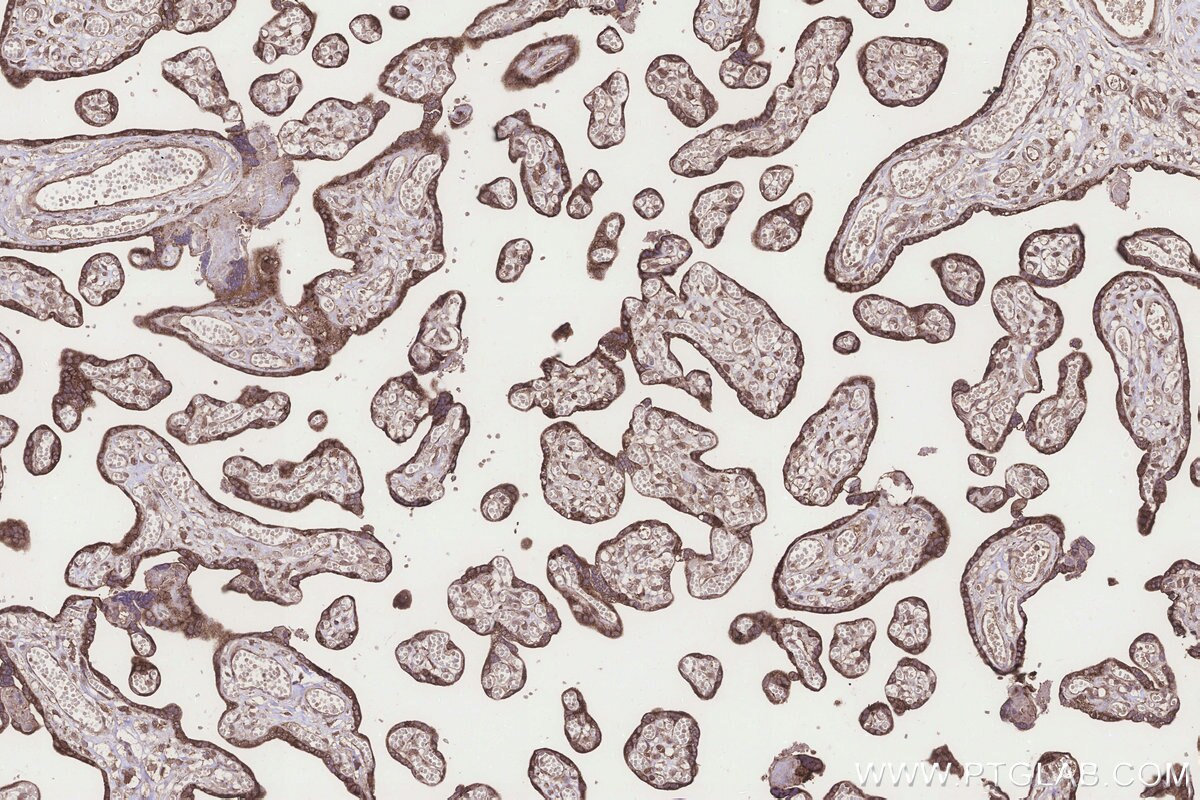 Immunohistochemical analysis of paraffin-embedded human placenta tissue slide using KHC3265 (MTARC1/MOSC1 IHC Kit). Immunohistochemical analysis of paraffin-embedded human placenta tissue slide using KHC3265 (MTARC1/MOSC1 IHC Kit).