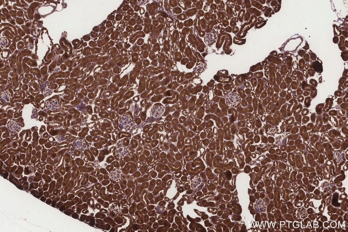 Immunohistochemical analysis of paraffin-embedded mouse kidney tissue slide using KHC3265 (MTARC1/MOSC1 IHC Kit). Immunohistochemical analysis of paraffin-embedded mouse kidney tissue slide using KHC3265 (MTARC1/MOSC1 IHC Kit).
