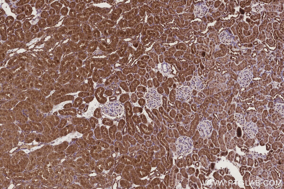Immunohistochemical analysis of paraffin-embedded rat kidney tissue slide using KHC3265 (MTARC1/MOSC1 IHC Kit). Immunohistochemical analysis of paraffin-embedded rat kidney tissue slide using KHC3265 (MTARC1/MOSC1 IHC Kit).
