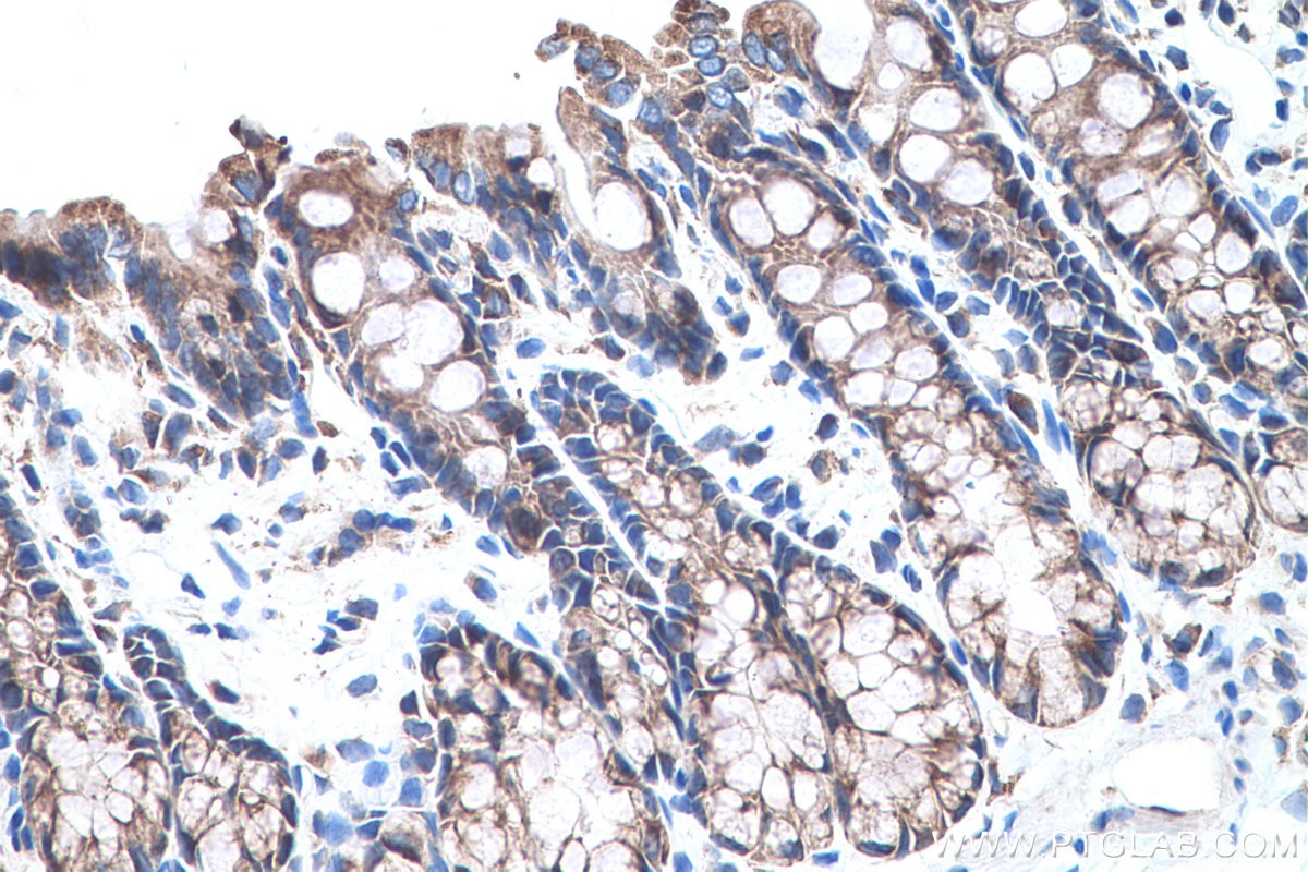 Immunohistochemical analysis of paraffin-embedded rat colon tissue slide using KHC0575 (MTCO2 IHC Kit).