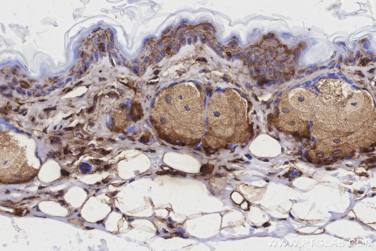 Immunohistochemical analysis of paraffin-embedded mouse skin tissue slide using KHC3160 (MTCO3 IHC Kit).